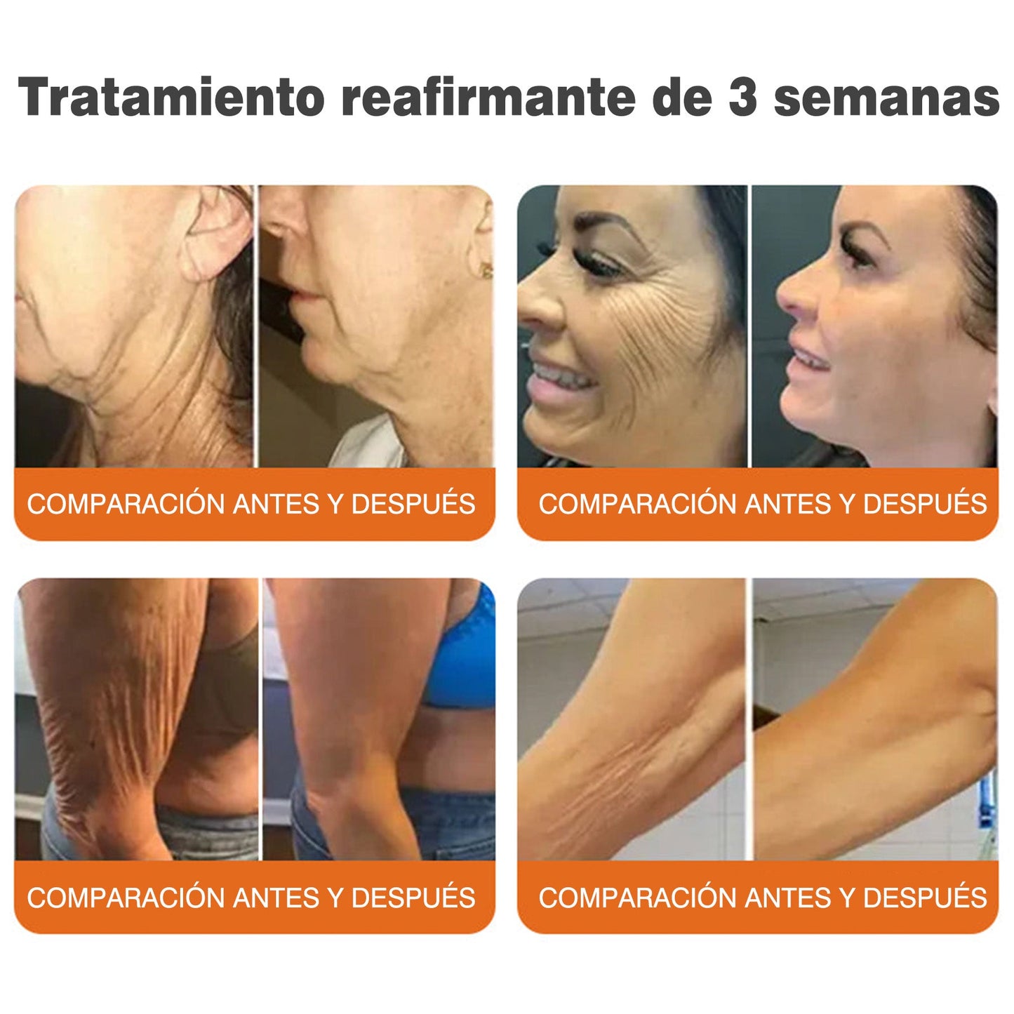 🔥🔥Fabricado y enviado desde el Reino Unido 🇪🇸 Rolimey® Stick Serum Reafirmante con Veneno de Abeja tipo Botox (⏳¡ÚLTIMO DÍA! 70% DE DESCUENTO)🛫