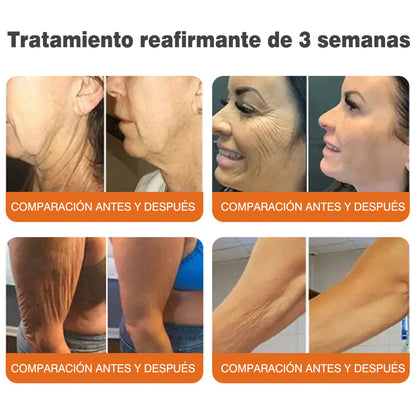 🔥🔥Fabricado y enviado desde el Reino Unido 🇪🇸 Rolimey® Stick Serum Reafirmante con Veneno de Abeja tipo Botox (⏳¡ÚLTIMO DÍA! 70% DE DESCUENTO)🛫