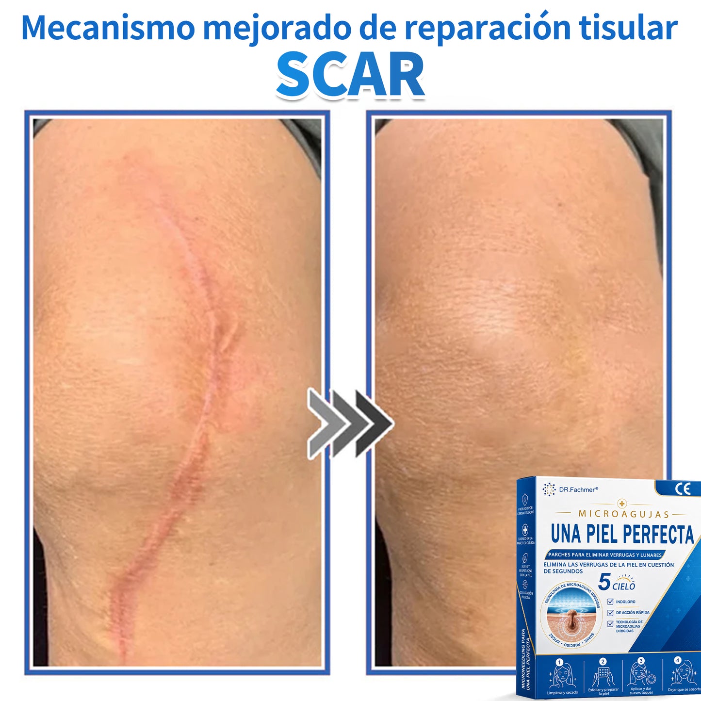 🎁🎁Disfruta de un 50% DE DESCUENTO al añadir el segundo producto🎁🎁