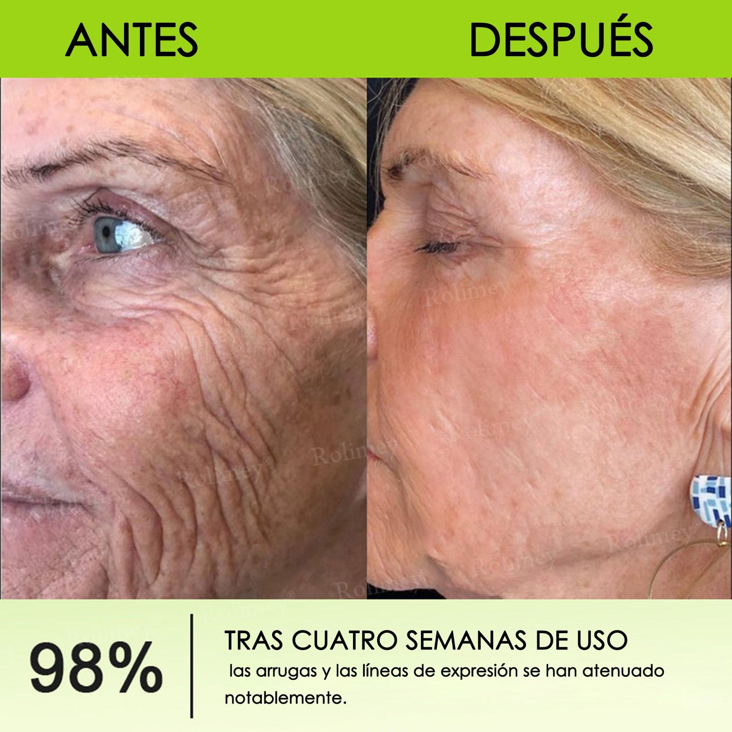 Fabricado y enviado desde España 👨‍⚕️Rolimey® Botox & Vita-A Retinol Shot Crema reafirmante y lifting antiarrugas - Promoción de último día 50% de descuento