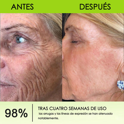 Fabricado y enviado desde España 👨‍⚕️Rolimey® Botox & Vita-A Retinol Shot Crema reafirmante y lifting antiarrugas - Promoción de último día 50% de descuento