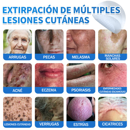🎁🎁Disfruta de un 50% DE DESCUENTO al añadir el segundo producto🎁🎁