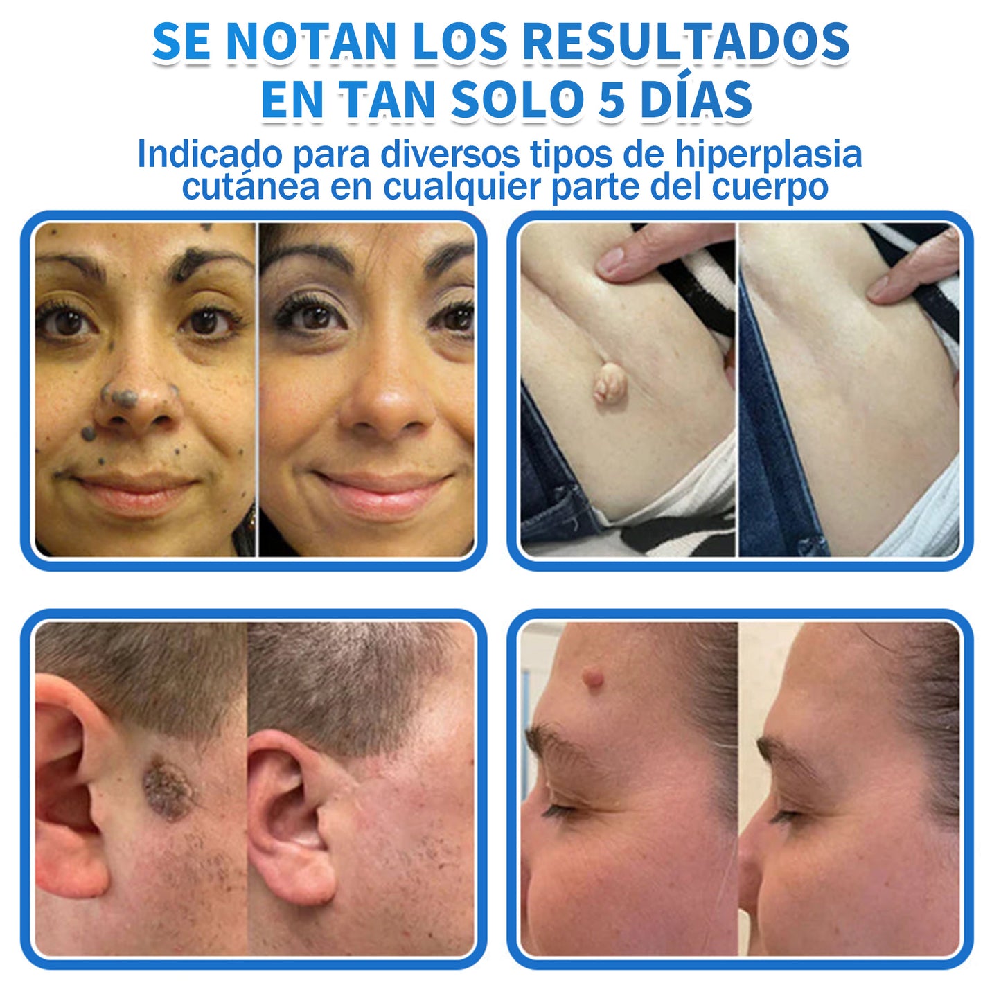 🎁🎁Disfruta de un 50% DE DESCUENTO al añadir el segundo producto🎁🎁