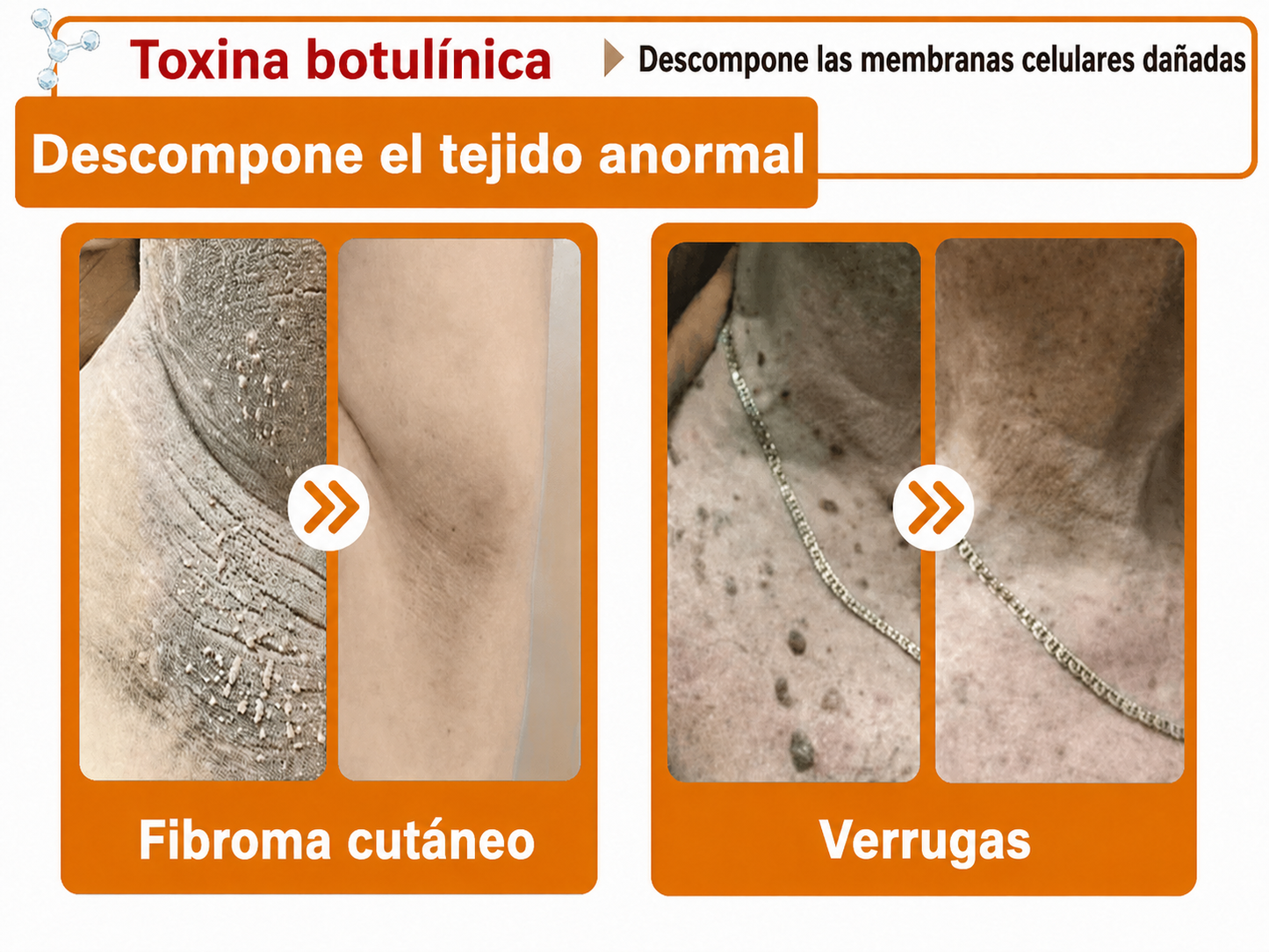🔥🔥Versión mejorada con nuevo envase 2026丨⚡️ROLIMEY® PDRN crema roll-on multipeptídica para reafirmar, regenerar y suavizar la piel
