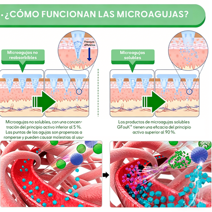 👨‍⚕️Nueva actualización 2026:𝑮𝑭𝑶𝑼𝑲® 𝑩𝒆𝒓𝑏𝘦𝘳𝑖𝗇𝒆 10-𝗶𝙣-𝟏 𝑁𝑎𝑛𝑜 𝘔𝘪𝘤𝘳𝘰𝘯𝘦𝘦𝘥𝘭𝘦 𝖯𝚊𝗍𝖼𝗁 con fórmula respaldada por la ciencia🌿