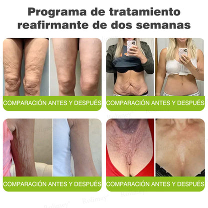 Fabricado y enviado desde España 👨‍⚕️Rolimey® Botox & Vita-A Retinol Shot Crema reafirmante y lifting antiarrugas - Promoción de último día 50% de descuento