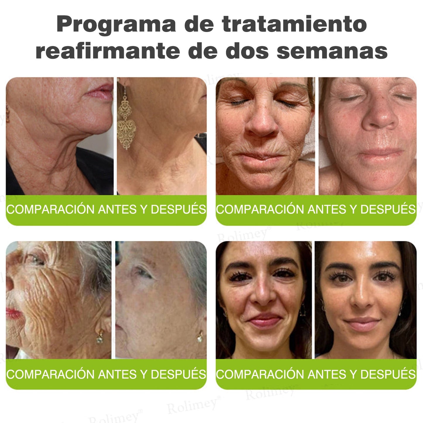 Fabricado y enviado desde España 👨‍⚕️Rolimey® Botox & Vita-A Retinol Shot Crema reafirmante y lifting antiarrugas - Promoción de último día 50% de descuento