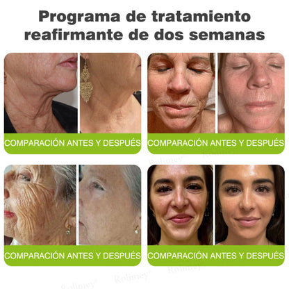 Fabricado y enviado desde España 👨‍⚕️Rolimey® Botox & Vita-A Retinol Shot Crema reafirmante y lifting antiarrugas - Promoción de último día 50% de descuento
