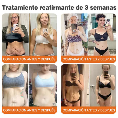 🔥🔥Fabricado y enviado desde el Reino Unido 🇪🇸 Rolimey® Stick Serum Reafirmante con Veneno de Abeja tipo Botox (⏳¡ÚLTIMO DÍA! 70% DE DESCUENTO)🛫