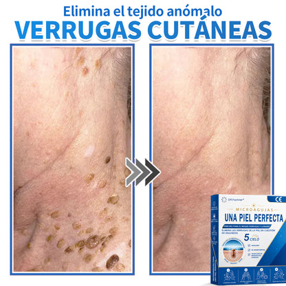 🎁🎁Disfruta de un 50% DE DESCUENTO al añadir el segundo producto🎁🎁