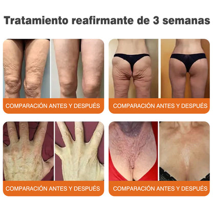 🔥🔥Fabricado y enviado desde el Reino Unido 🇪🇸 Rolimey® Stick Serum Reafirmante con Veneno de Abeja tipo Botox (⏳¡ÚLTIMO DÍA! 70% DE DESCUENTO)🛫