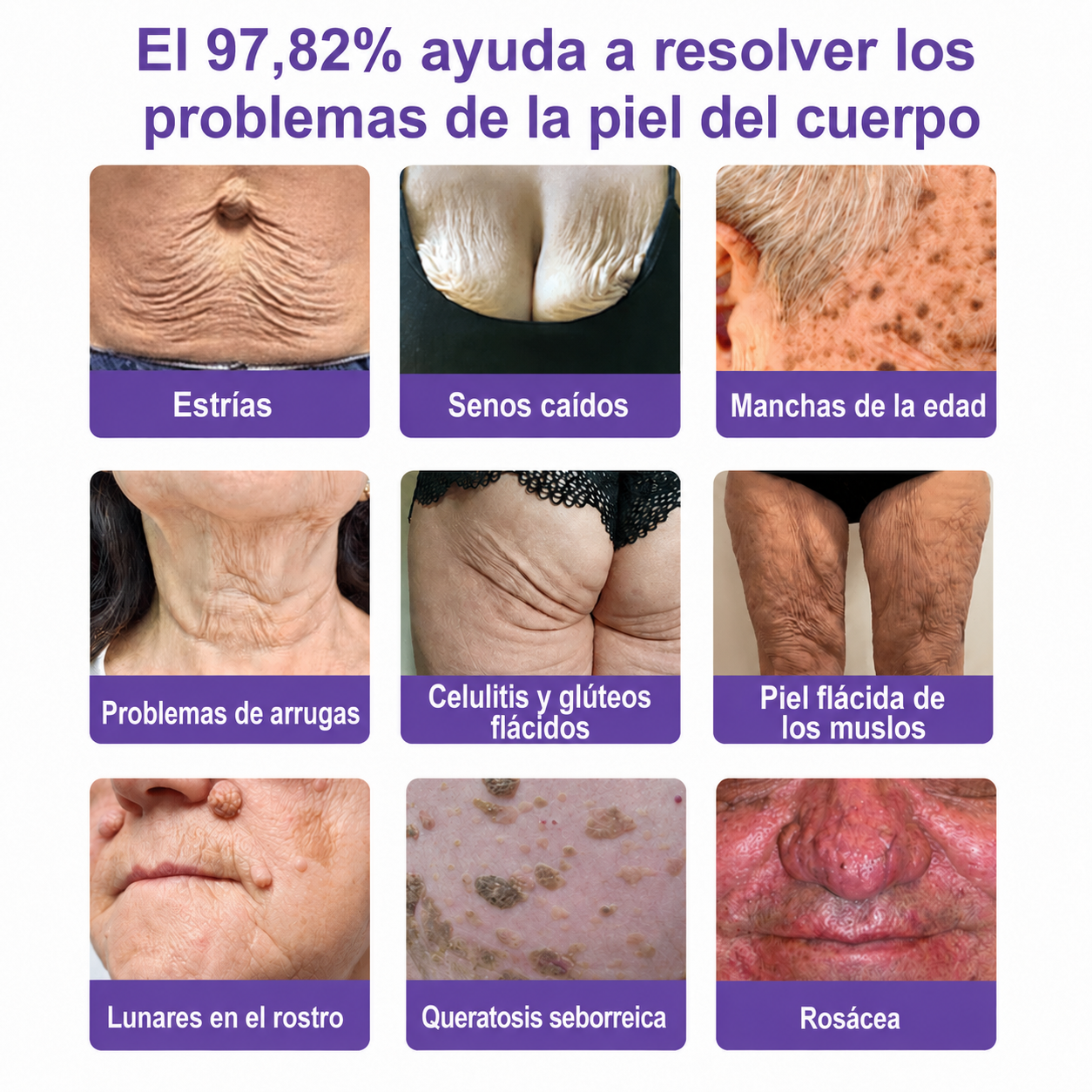 🔥🔥Versión mejorada con nuevo envase 2026丨⚡️ROLIMEY® PDRN crema roll-on multipeptídica para reafirmar, regenerar y suavizar la piel