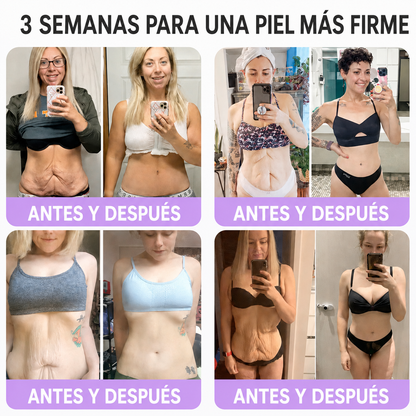 🔥🔥Versión mejorada con nuevo envase 2026丨⚡️ROLIMEY® PDRN crema roll-on multipeptídica para reafirmar, regenerar y suavizar la piel