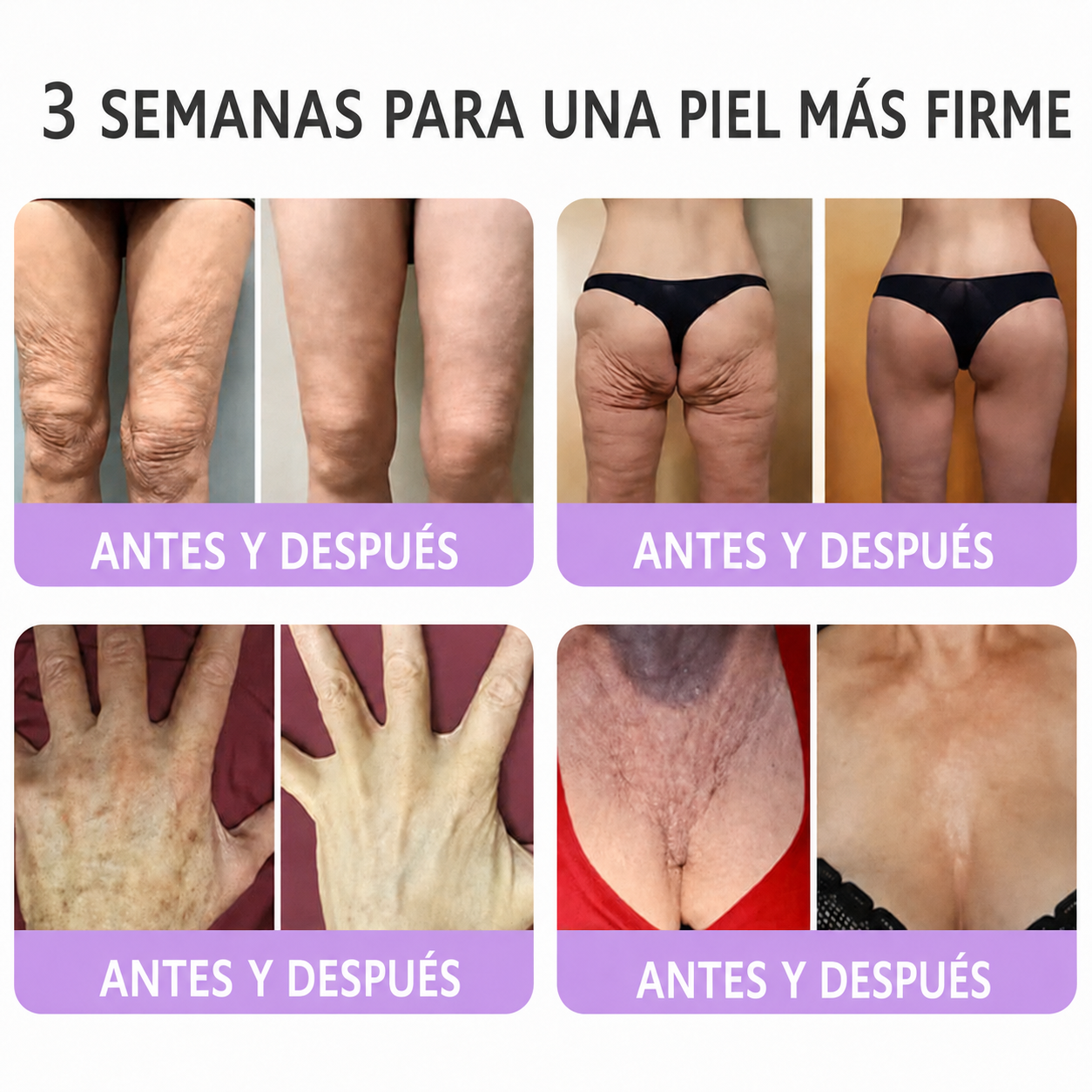 🔥🔥Versión mejorada con nuevo envase 2026丨⚡️ROLIMEY® PDRN crema roll-on multipeptídica para reafirmar, regenerar y suavizar la piel